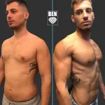 antes-depues-29-150x150