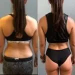 antes-despues-17-150x150