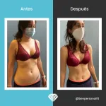 antes-despues-2-150x150